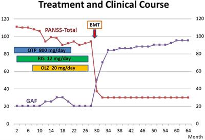 Remission of Psychosis in Treatment-Resistant Schizophrenia following Bone Marrow Transplantation: A Case Report